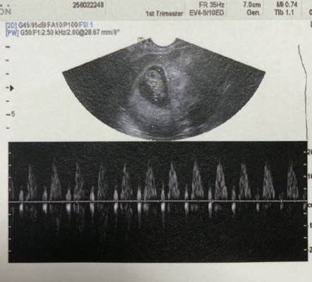โดนไฟช๊อตค่ะ วันนี้ 9 weeks พอดี ... ตกใจมาก