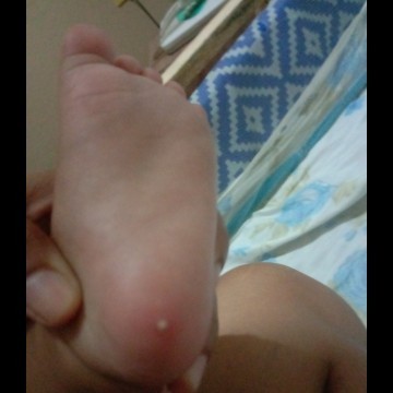 hi po ask lang po kung my idea po dito sa paa ni lo matigas naman po sya thank you sa makakapansin