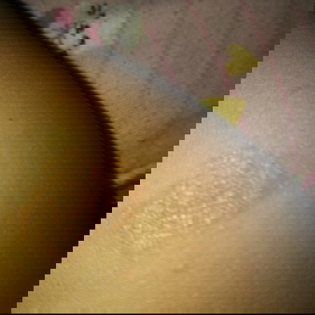 Di kasih salep apa yaa bund,aku perhatiin lama" kaya makin melebar