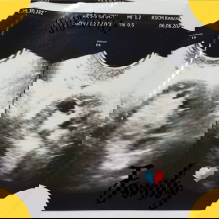 Aku Yakin Anakku masih Ada