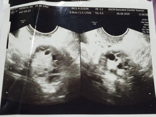 Aku Yakin Anakku Masih Ada