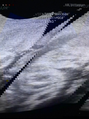 ขอสอบถามหน่อยค่ะ