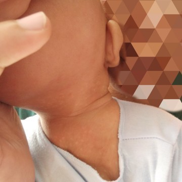 bercak putih kecil2