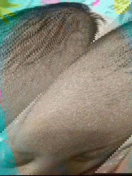 Kerak di kepala bayi