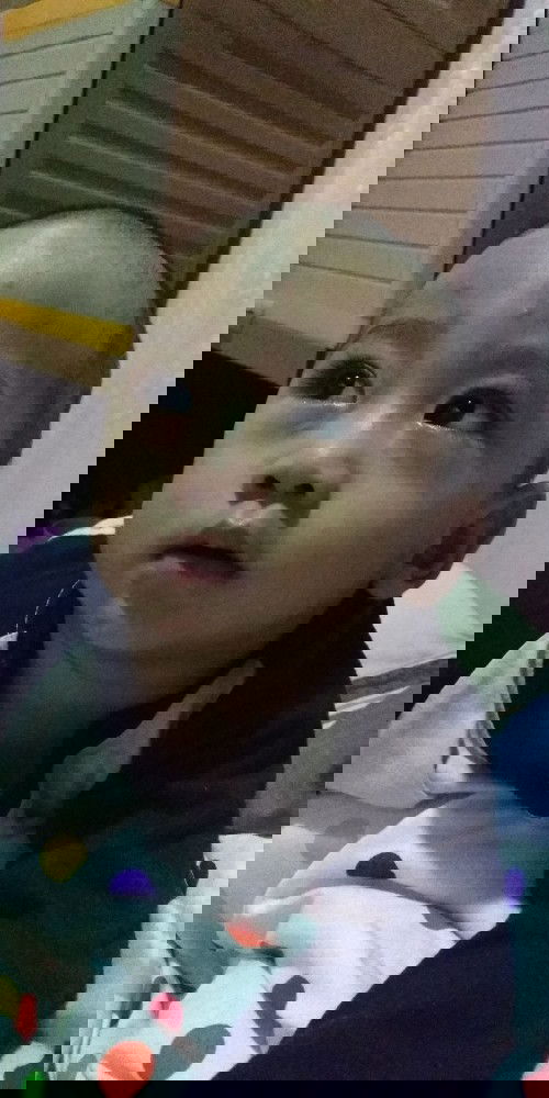 Cacar air pada anak umur 17 bulan