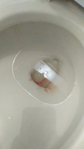 Bleeding :(