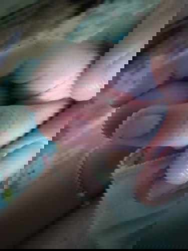 Kuku tangan be nanah