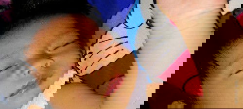 Ruam pada muka dan badan