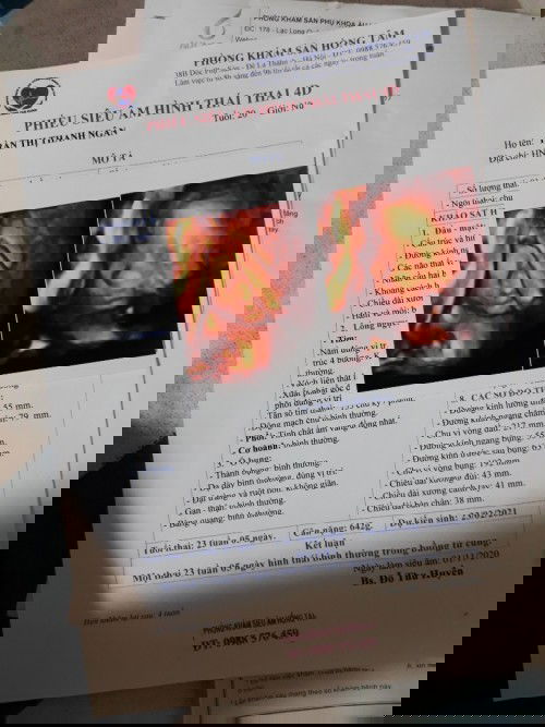 Quan tâm xin ý kiến các m