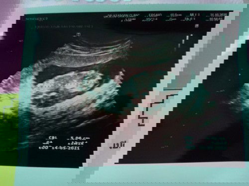 ขอดูท่านอนน้องหน่อยค่ะ😍