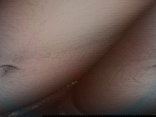 Bunda pernah ngalami nya nggak? ini tahu nggak kenapa ya banyak kali bulu nya?