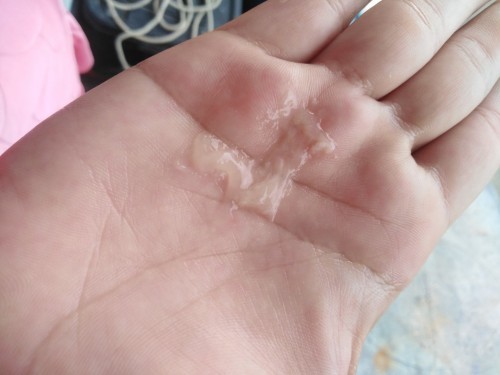สอบถามแม่ๆค่ะ