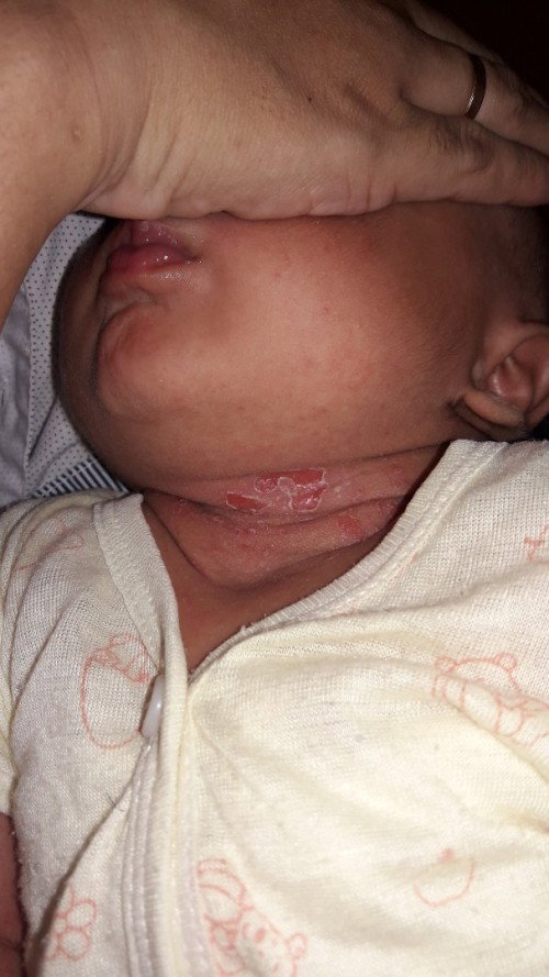 Baby ku 15hari