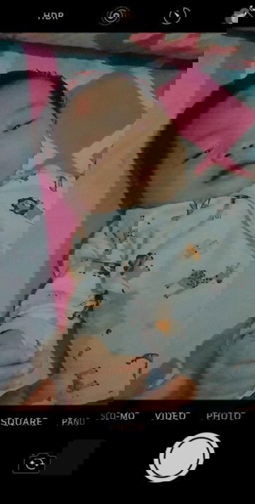 Pusar berair, bibir hitam, perut kembung