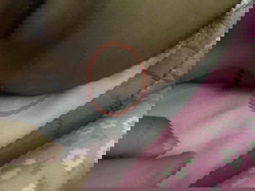 Skin problem, need advice