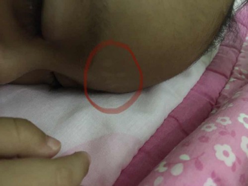 Skin problem, need advice