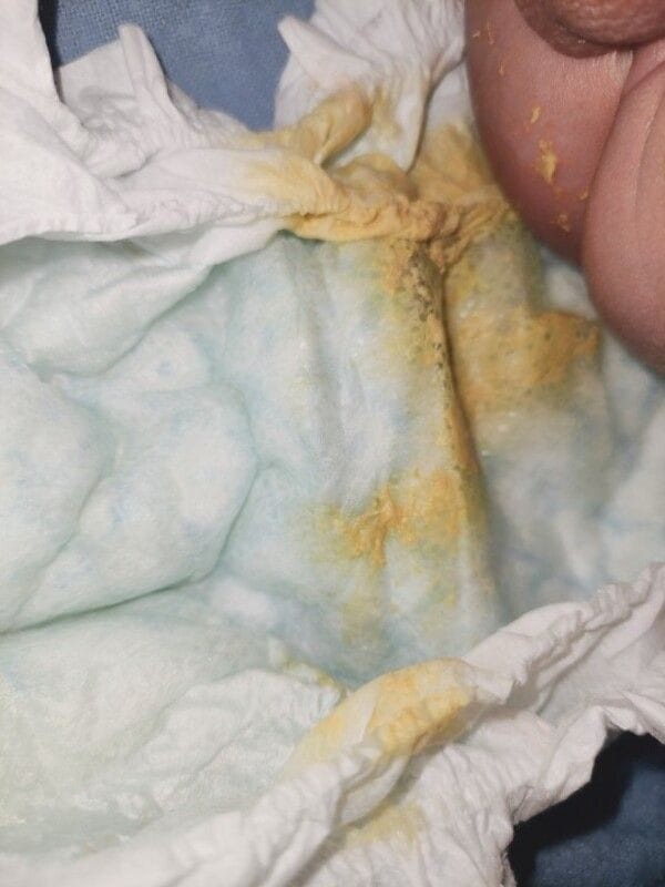 Baby poop...