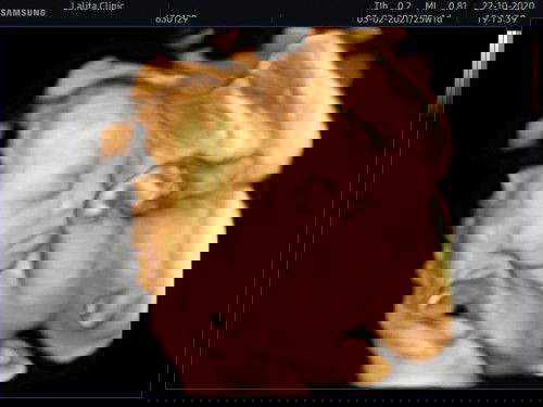 ข้อดูภาพอัตซาวด์ของแม่ๆหน่อยค่ะ
บ้านนี้6เดือนจะ7แล้วค่ะ กำหนดคลอด 3 ก.พ64😚👶