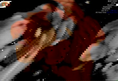 Umur 23week jarang gerak babyny normal gak sih mom ??aku suka kepikiran jdinya