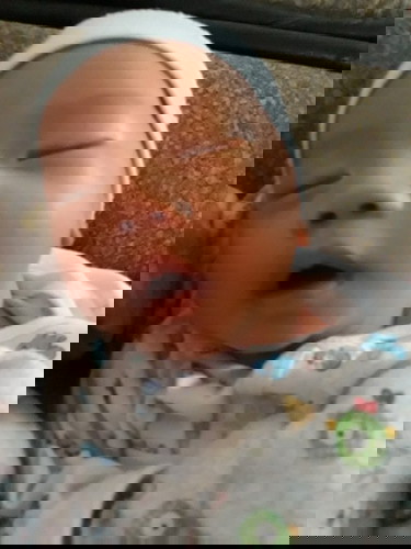 เด็กแรกเกิดเป็นไทรอยด์