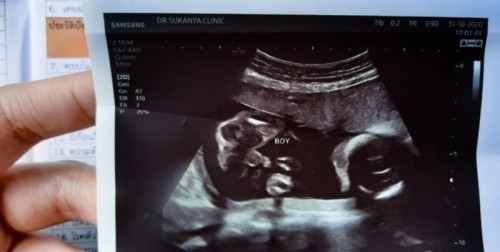 20weekน้องหนักกี่กรัมกันบ้างคะ