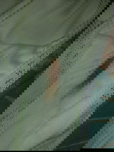Brown Discharge at 27 weeks