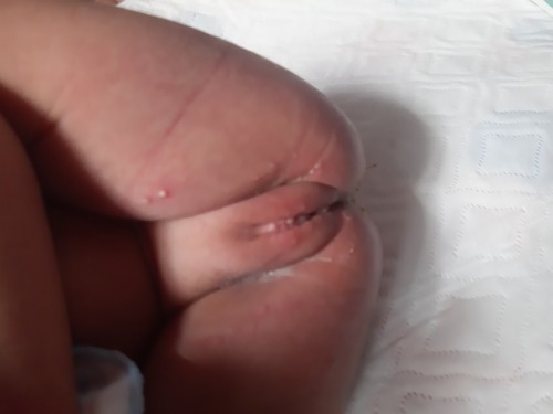 rashes pls help remedy