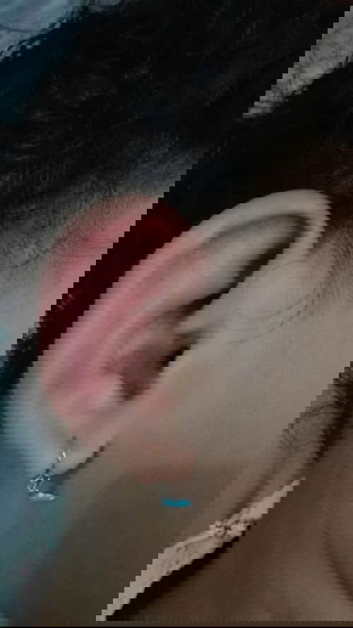 Telinga anak bengkak