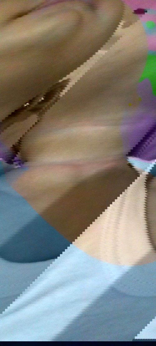 Merah2 dilipatan leher