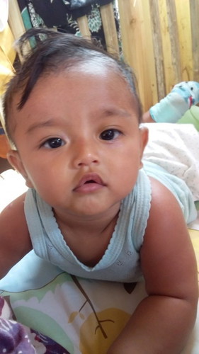 Cara mengatasi anak yg sering batuk" apa ya bun sadh ke bidan belom juga membaik.tlong saranx bunda