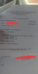 Matutuloy pa kaya tong pagbubuntis ko?