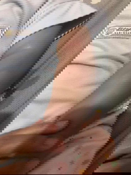 Obat bentol buat bayi