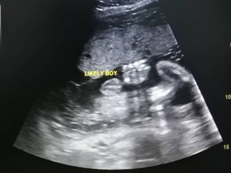 hi moms rasanya ni betul2 boy ke. doc ckap MACAM boy tp knapa sy tgk macam gegurl yang punya