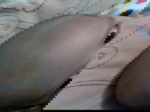 Galau rambut ga tumbuh2