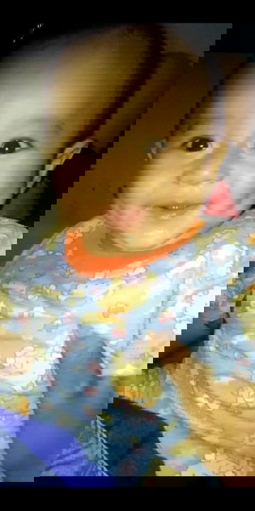 cara ngilangin bekas gigitan nyamuk