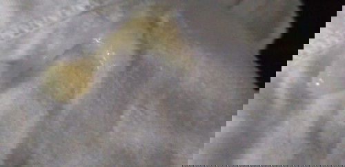 Mucus plug po ba to???