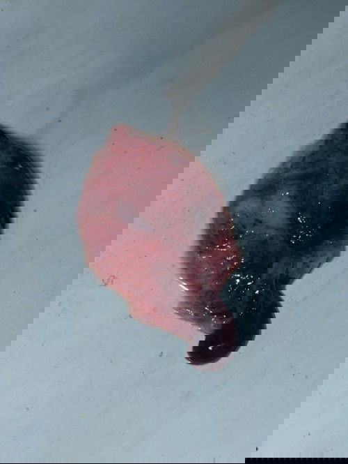 แบบนี้คือน้องไม่อยู่กับเราแล้วใช่มั้ยคะ