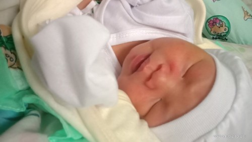 Ano po kaya pwdeng vitamins ng baby ko pangatlong araw napo nya ngyon.. Parang dilaw prin po kulay .