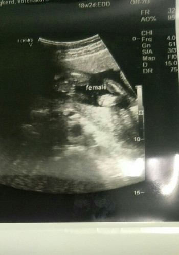 มีโอกาสเป็นผู้ชายไหมค่ะ