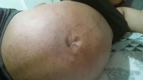 skin problem