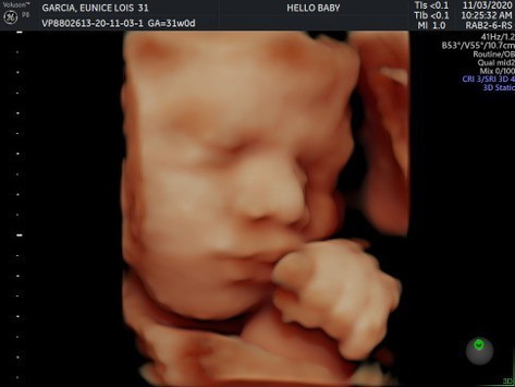 My baby boy's 4D scan 😊