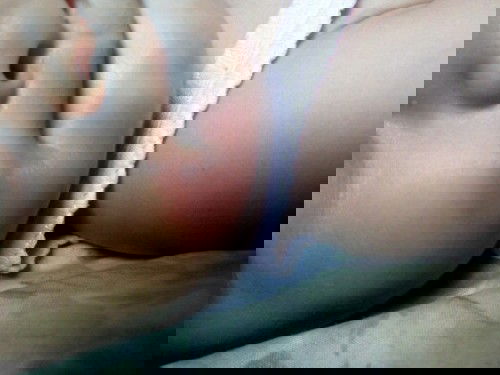 ALERGI MAKANAN. usia 7 bulan.