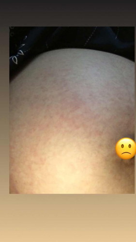 แม่คนไหนเป็นแบบนี้บ้างค่ะ