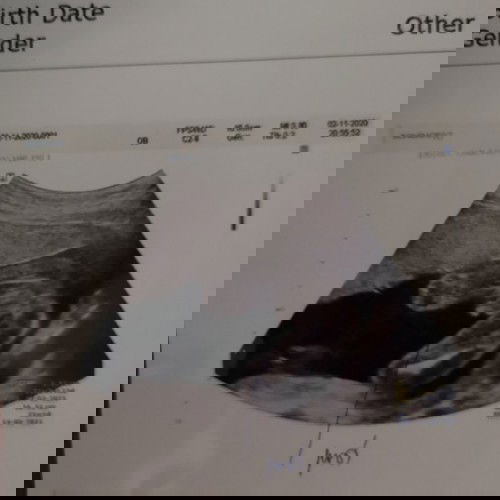 ขอดูรูปเด็กๆเดือนมีนาหน่อยคะ💕