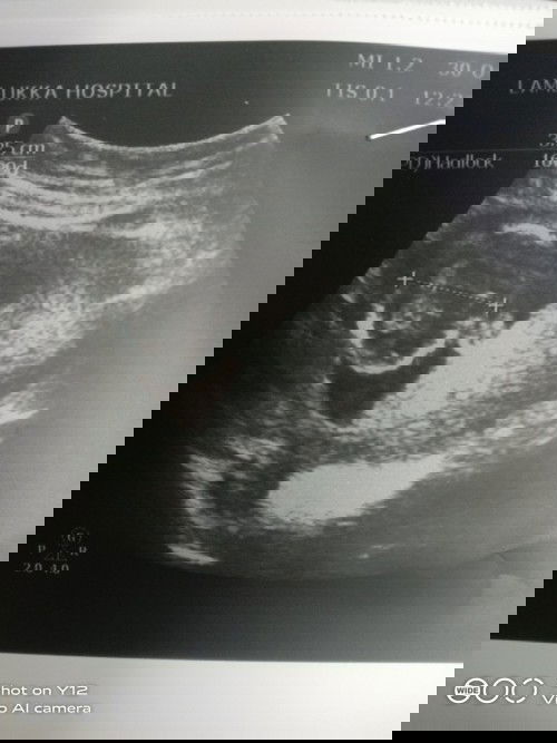 ขอเสียงคุณแม่ทีม เมษา 64 หน่อยค่ะ
คุณแม่บ้านไหนมีอาการแพ้บ้างค่ะ
แม่บ้านนี้ไม่มีอะไรใดๆเลย