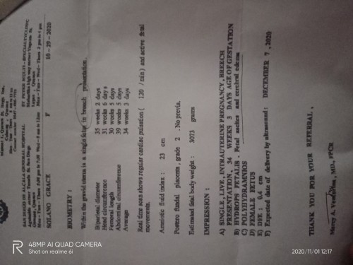 im 35 weeks and 1 day now and my baby was diagnosed with hydrops fetalis. can she survived?