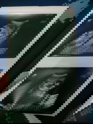 เพศของน้องง