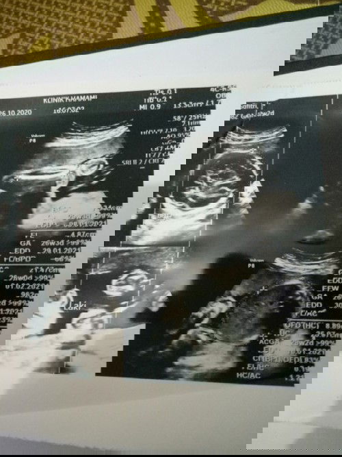 nyesek mulut tetangga