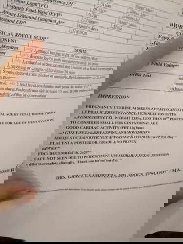 low estimated fetal weight