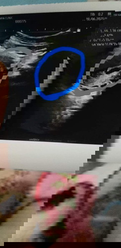 อยากรู้ว่าอัลตร้าซาวด์ เห็นเด็กกันตอนกี่วีคค่ะ ?
ตอนนี้ของเรา7wเเต่ยังไม่เห้นตัวเด็กเลย...